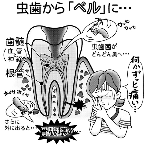 気になる症状 すっきり診断 ３３ 歯の根がしつこく痛んだら 河北新報オンラインニュース Online News