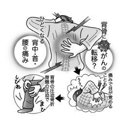 気になる症状 すっきり診断 ５０ ひどくなる背中の痛み がんの骨転移の恐れも 河北新報オンラインニュース Online News