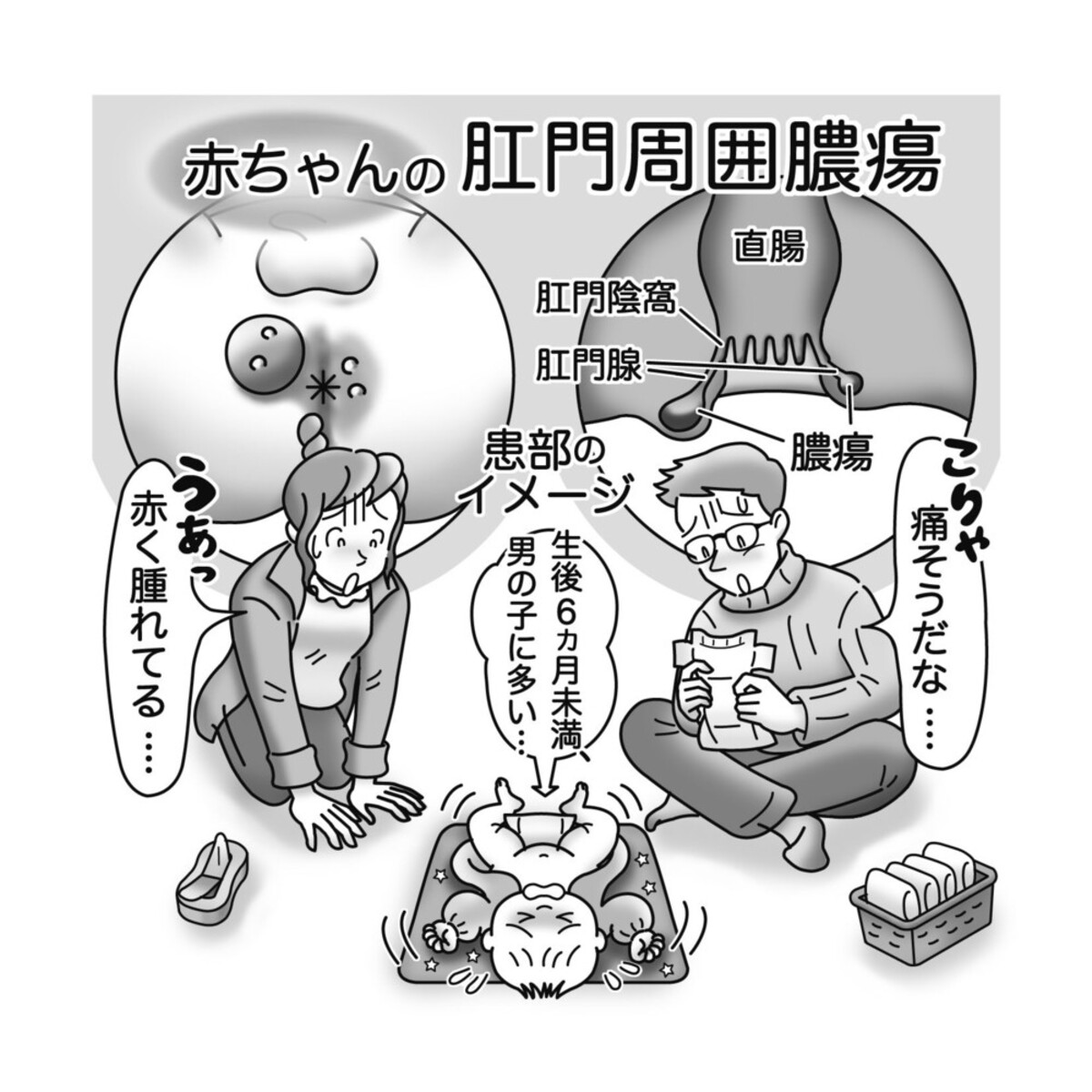 気になる症状 すっきり診断 ７３ 赤ちゃんの肛門の周りが腫れた 感染起こし膿がたまる 河北新報オンラインニュース Online News