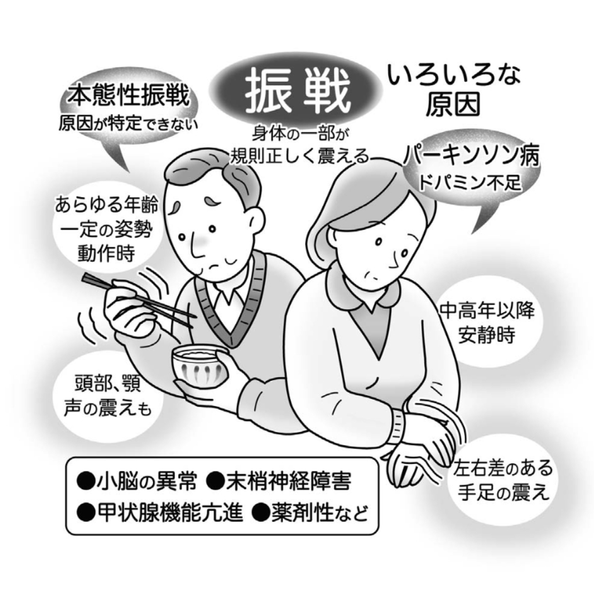 気になる症状 すっきり診断 ９１ 手足の震え 異常な動き見極め治療 河北新報オンラインニュース Online News