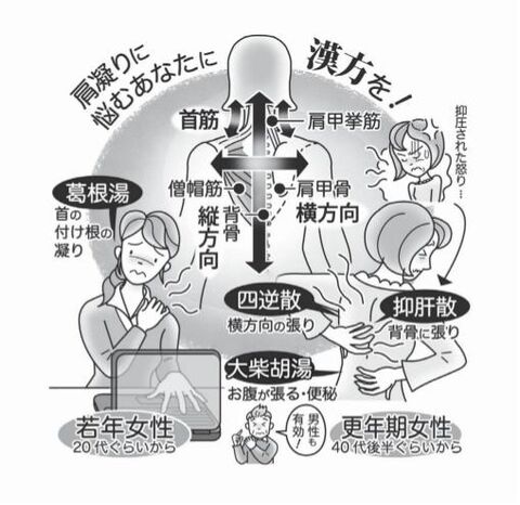 気になる症状 すっきり診断 ９７ 女性の肩凝り 漢方薬使い分けほぐす 河北新報オンラインニュース Online News