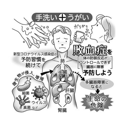 気になる症状 すっきり診断 ９９ 命脅かす敗血症 感染症の予防が最重要 河北新報オンラインニュース Online News