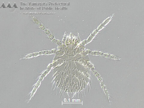 かさぶたのような刺し口 つつが虫病 今も死者 河北新報オンラインニュース Online News