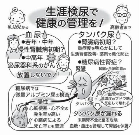 気になる症状 すっきり診断 １０５ 検査でタンパク尿が出た 血糖管理し腎臓保護を 河北新報オンラインニュース Online News