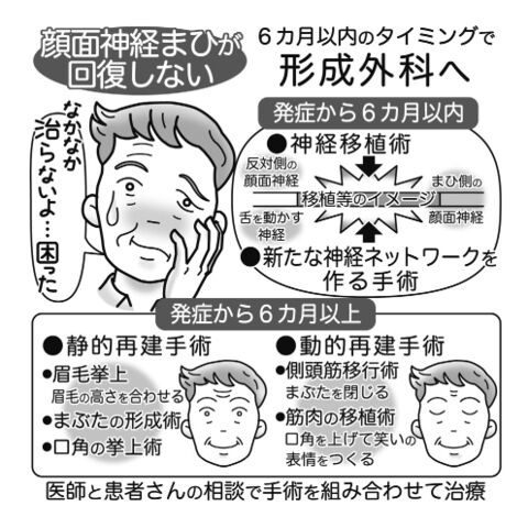 気になる症状 すっきり診断 １０６ 表情筋動かぬ顔面神経まひ 半年以内に受診 手術を 河北新報オンラインニュース Online News